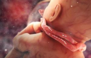 Пуповина и беременность: Когда обвитие не является проблемой